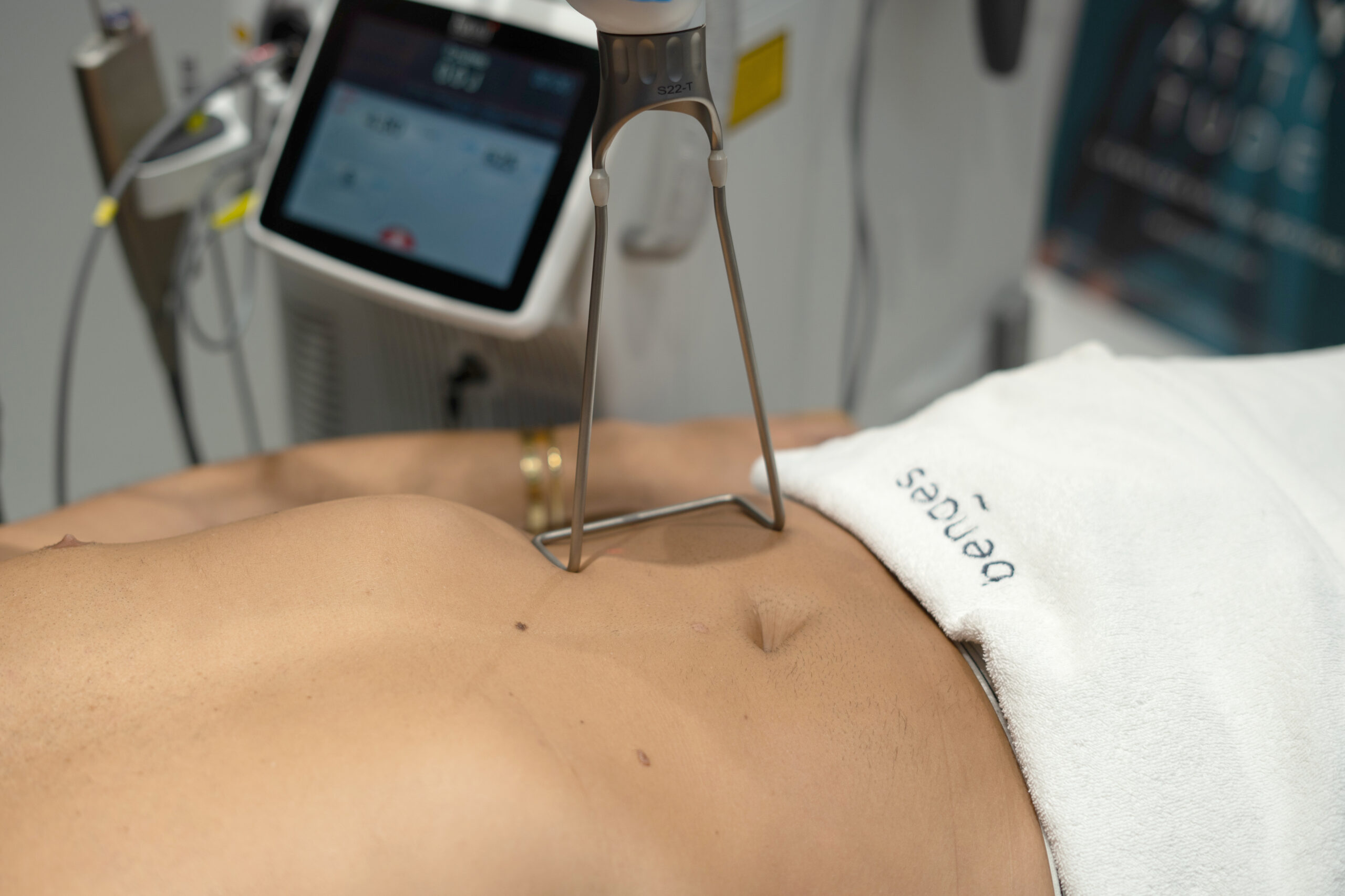 LaserFirming