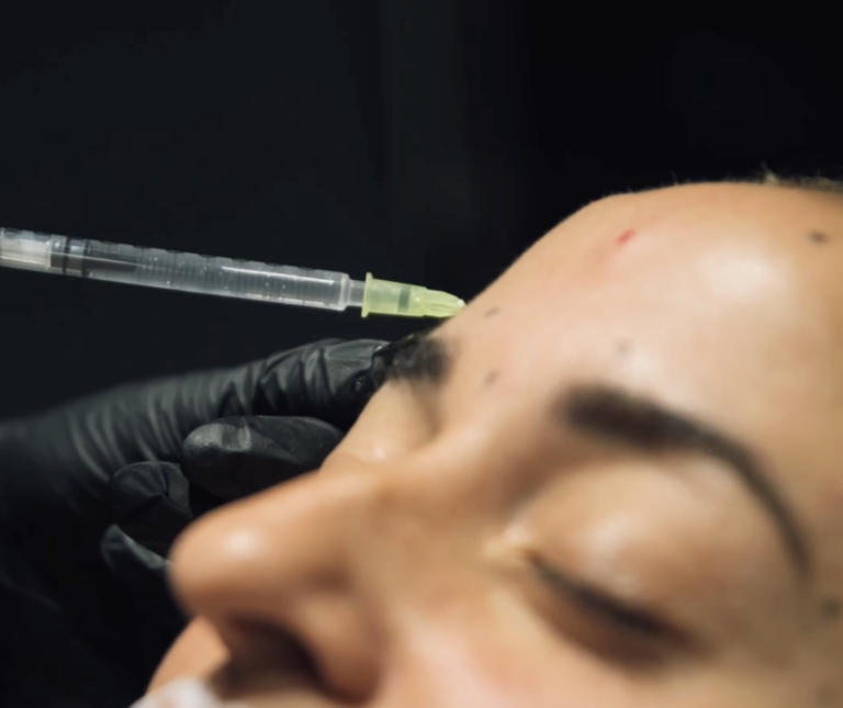 Mesoterapia Facial