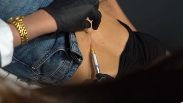 Mesoterapia corporal