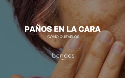 ¿Qué son los paños de la cara y cómo quitarlos?