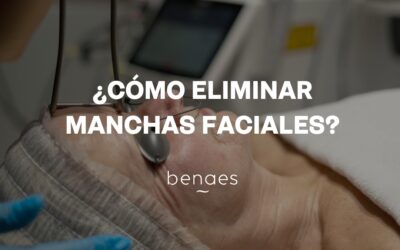 ¿Cómo eliminar las manchas de la cara?