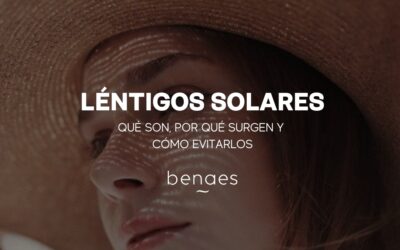 Léntigos Solares: Qué son, Por qué surgen y Cómo evitarlos