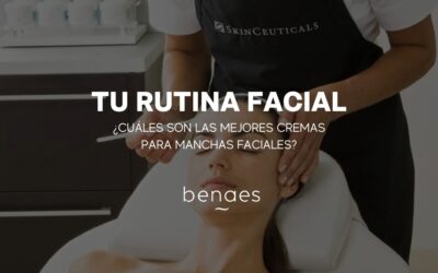 ¿Cuáles son las mejores cremas para las manchas de la cara?