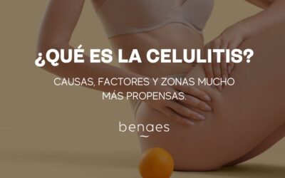¿Qué es la celulitis? Causas, factores y zonas más propensas