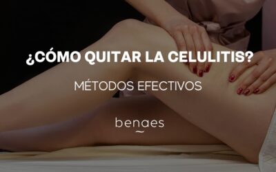 Cómo quitar la celulitis: métodos efectivos