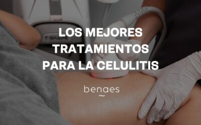 Los mejores tratamientos para la celulitis