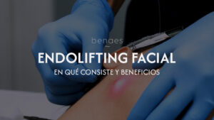 Endolifting facial: qué es, cómo funciona y qué resultados ofrece