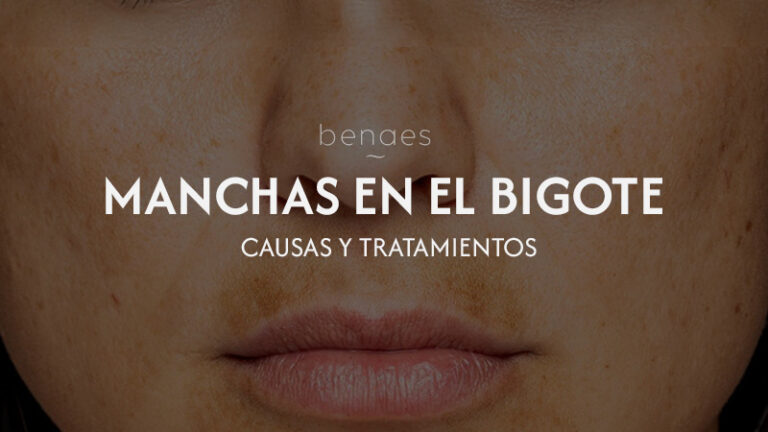 Manchas en el bigote: Causas y cómo tratarlas