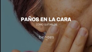 ¿Qué son los paños de la cara y cómo quitarlos?