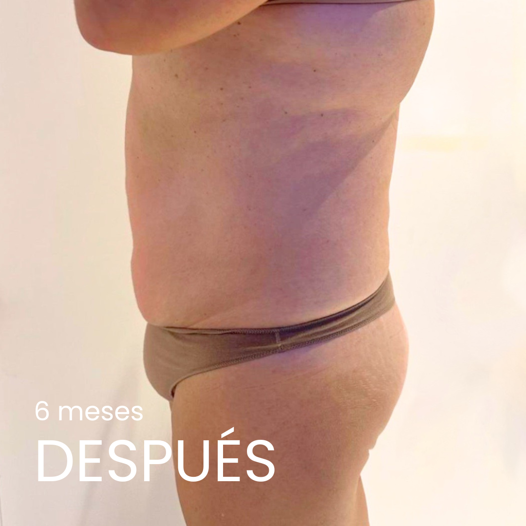 después adelgazamiento fármacos