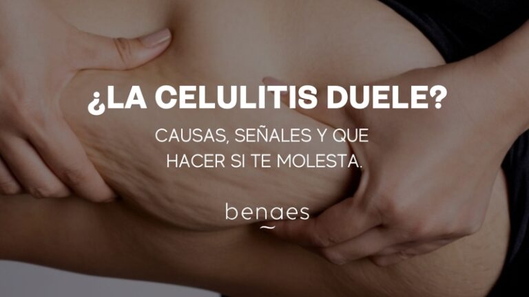 ¿La celulitis duele? Causas, señales y qué hacer si molesta