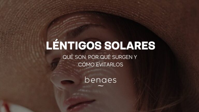 Léntigos solares: causas, síntomas y tratamientos
