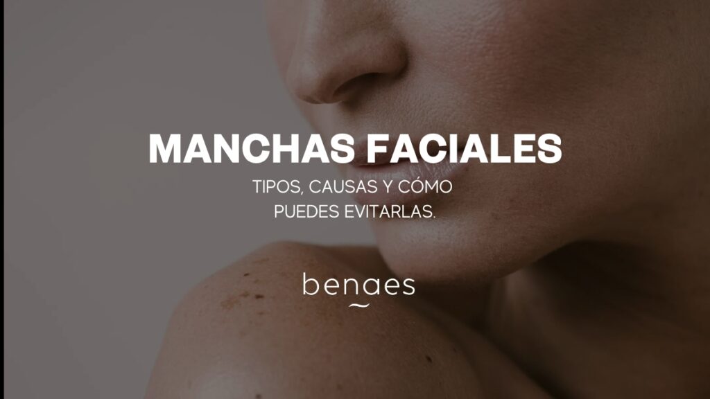 Manchas Faciales