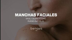 Manchas en la cara: tipos, causas y cómo evitarlas 