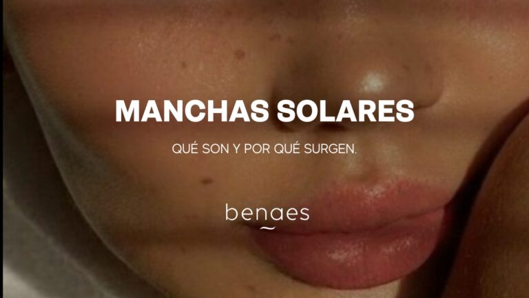 Manchas Solares; Qué son, Por qué surgen y Cómo prevenirlas