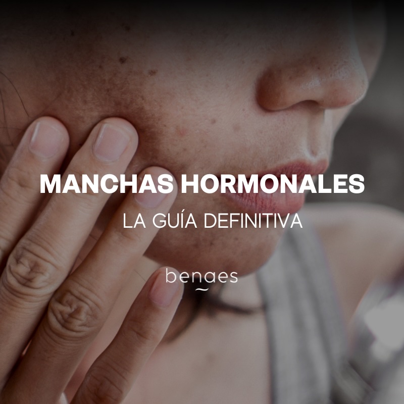 Manchas hormonales en la cara: la Guía definitiva
