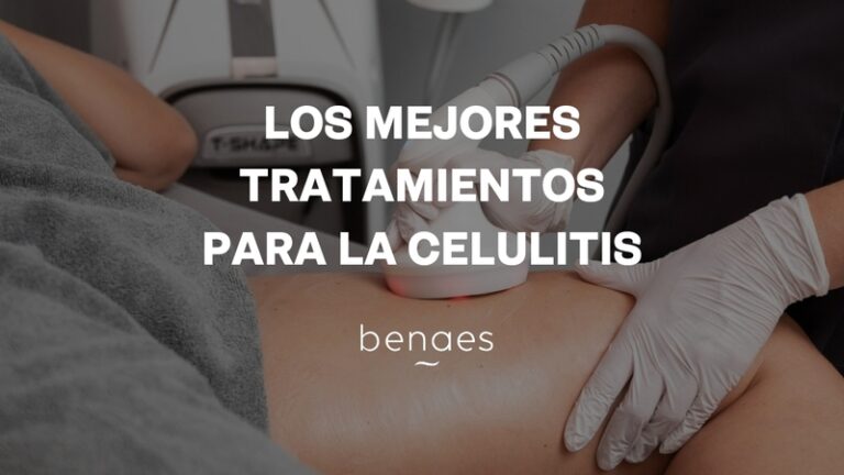 Los mejores tratamientos para la celulitis