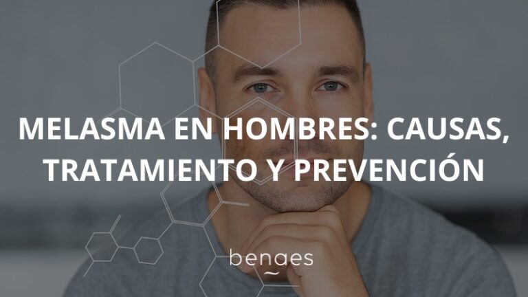 Melasma en hombres: causas, tratamientos y prevención
