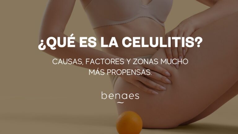 ¿Qué es la celulitis? Causas, factores y zonas más propensas