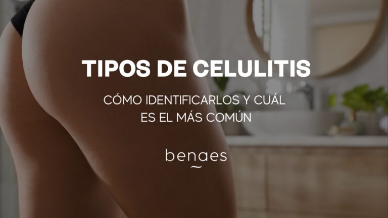 Tipos de celulitis