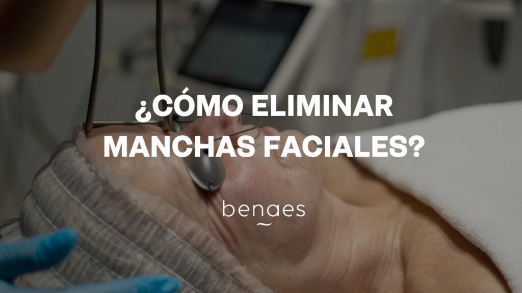 ¿Cómo eliminar las manchas faciales?