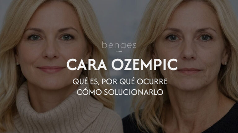 Cara Ozempic: qué es, por qué ocurre y cómo tratarla