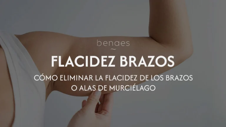 Cómo eliminar la flacidez de los brazos o alas de murciélago