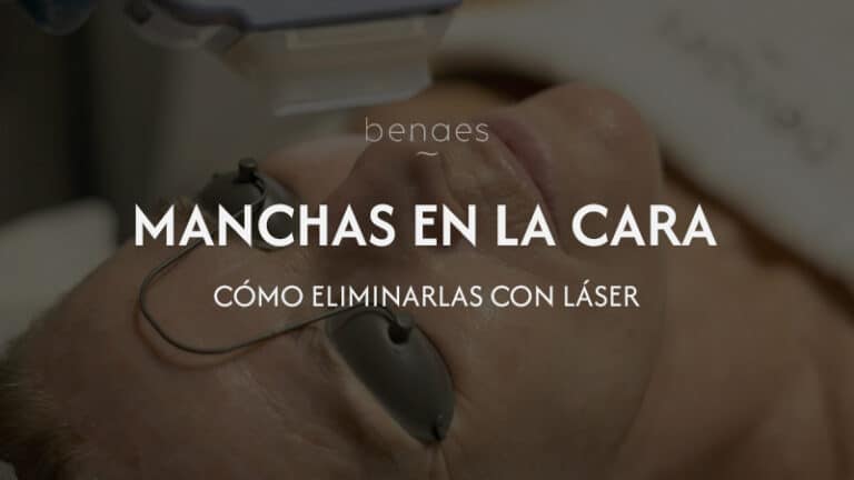Quitar las manchas de la cara con láser