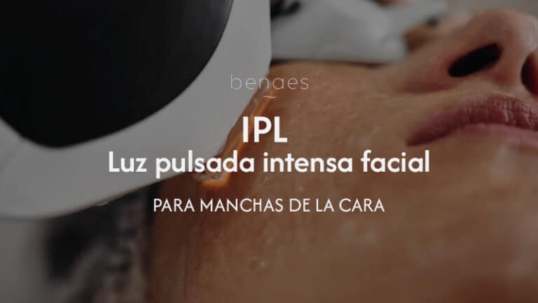 IPL para manchas de la cara: Luz Pulsada Intensa facial