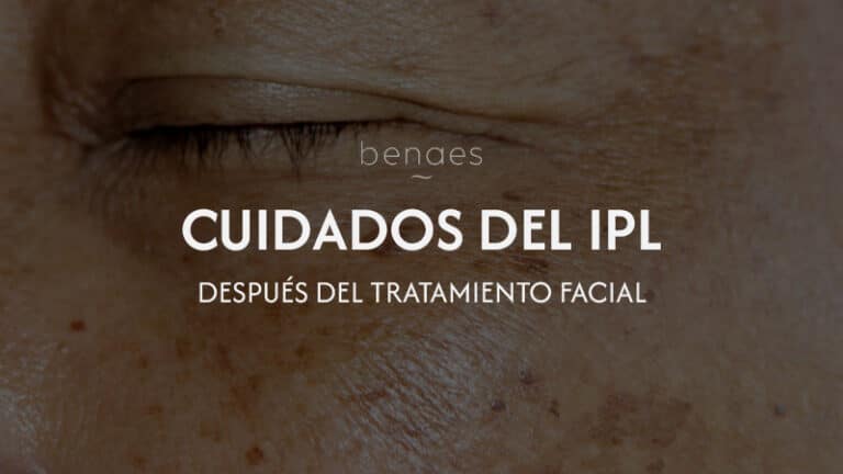Cuidados después del IPL facial