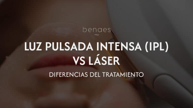 Luz Pulsada Intensa (IPL) o Láser: cuál elegir para las manchas