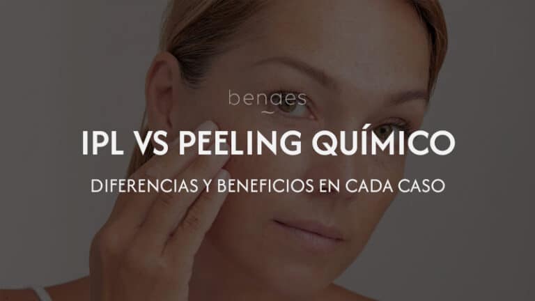 Láser IPL o peeling químico: ¿cuál elegir para tu piel?